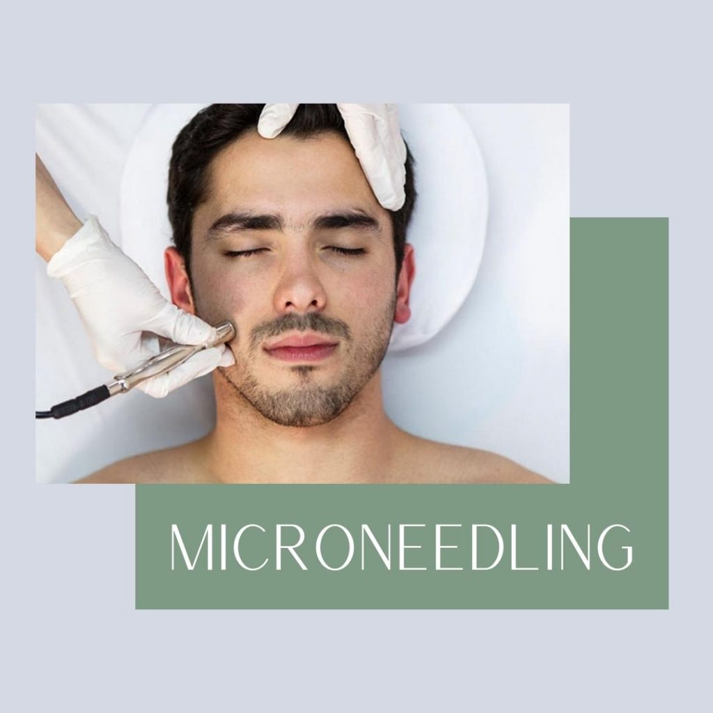 Microneedling Brooklyn